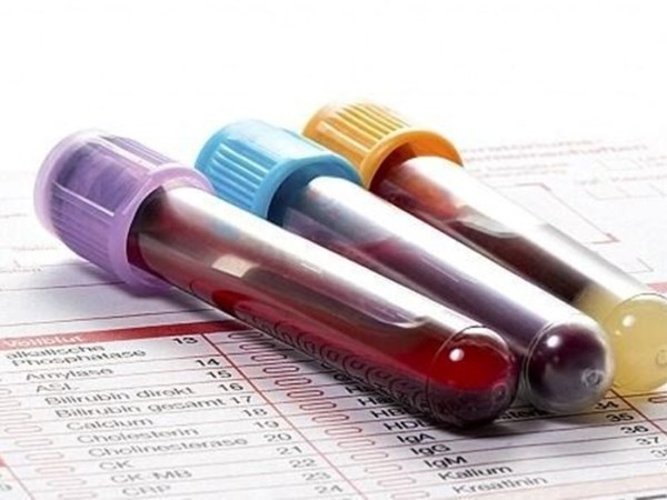 Why Choose an Urgent Care Clinic for Blood Work&nbsp;Today