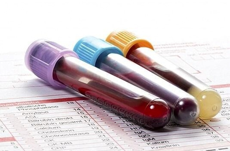 Why Choose an Urgent Care Clinic for Blood Work&nbsp;Today